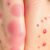 Jakie zadania ma dermatolog? Wszystko o chorobach skóry